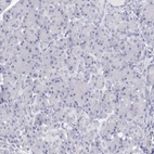 Immunohistochemical staining of human pancreas shows no positivity in exocrine glandular cells as expected.