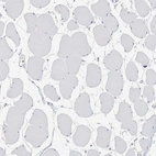 Immunohistochemical staining of human skeletal muscle shows no positivity in myocytes as expected.