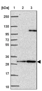 Lane 1: Marker [kDa] 250, 130, 95, 72, 55, 36, 28, 17, 10_br/_Lane 2: Human cell line RT-4_br/_Lane 3: Human cell line U-251 MG