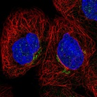 Anti-CYBRD1 Antibody