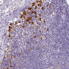 Anti-HK3 Antibody