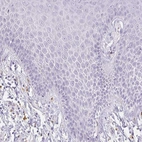 Immunohistochemical staining of human skin shows negative cytoplasmic positivity in squamous epithelial cells as expected.