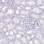 Anti-HK3 Antibody