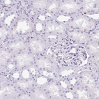 Immunohistochemical staining of human kidney shows negative cytoplasmic positivity in cells in tubules and cells in glomeruli as expected.