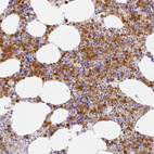 Immunohistochemical staining of human bone marrow shows strong cytoplasmic positivity in hematopoietic cells.