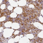 Immunohistochemical staining of human bone marrow shows strong cytoplasmic positivity in hematopoietic cells.