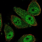 Anti-THSD7B Antibody