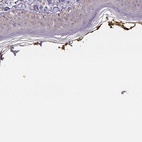 Immunohistochemical staining of human skin shows high expression.