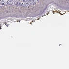 Immunohistochemical staining of human skin shows high expression.