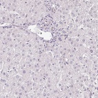 Anti-PLA2G4F Antibody