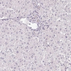 Immunohistochemical staining of human liver shows low expression as expected.