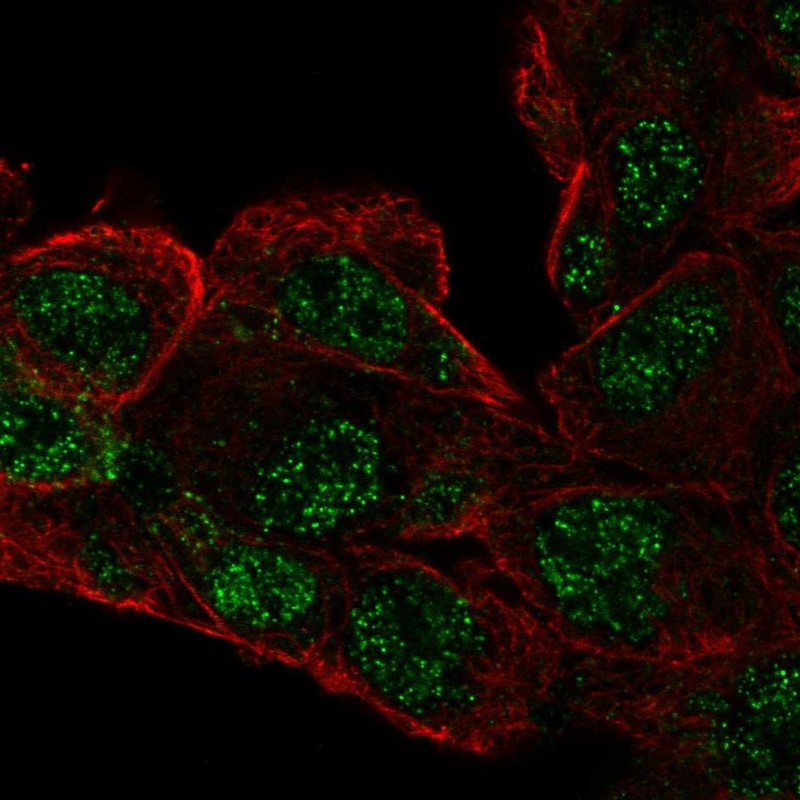 Anti-RCBTB1 Antibody
