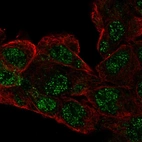 Anti-RCBTB1 Antibody
