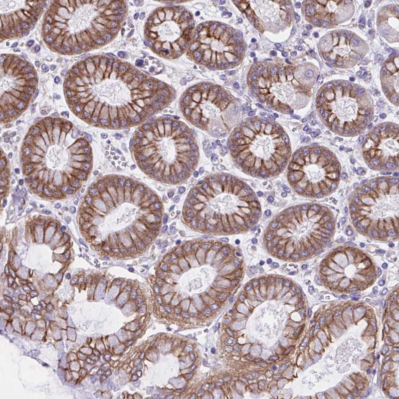 Anti-OR51M1 Antibody