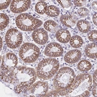 Anti-OR51M1 Antibody
