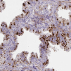 Anti-NPY Antibody