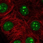 Immunofluorescent staining of human cell line MCF7 shows localization to nucleus & nucleoli.