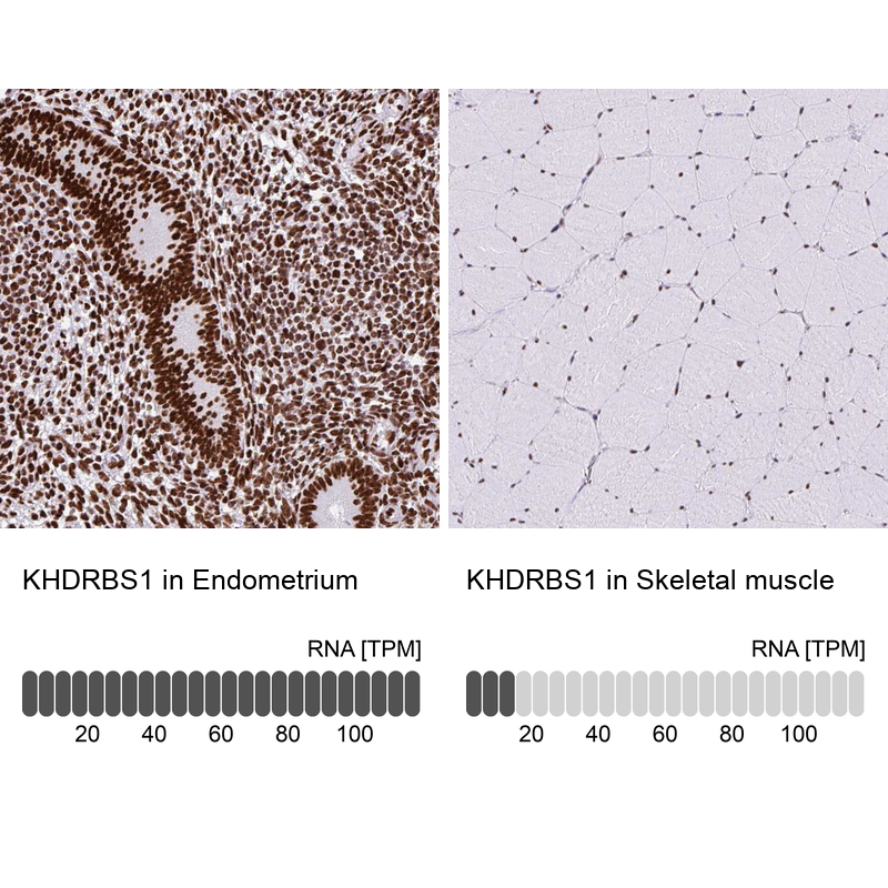 Anti-KHDRBS1 Antibody