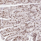 Anti-CCDC12 Antibody