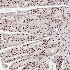 Anti-CCDC12 Antibody
