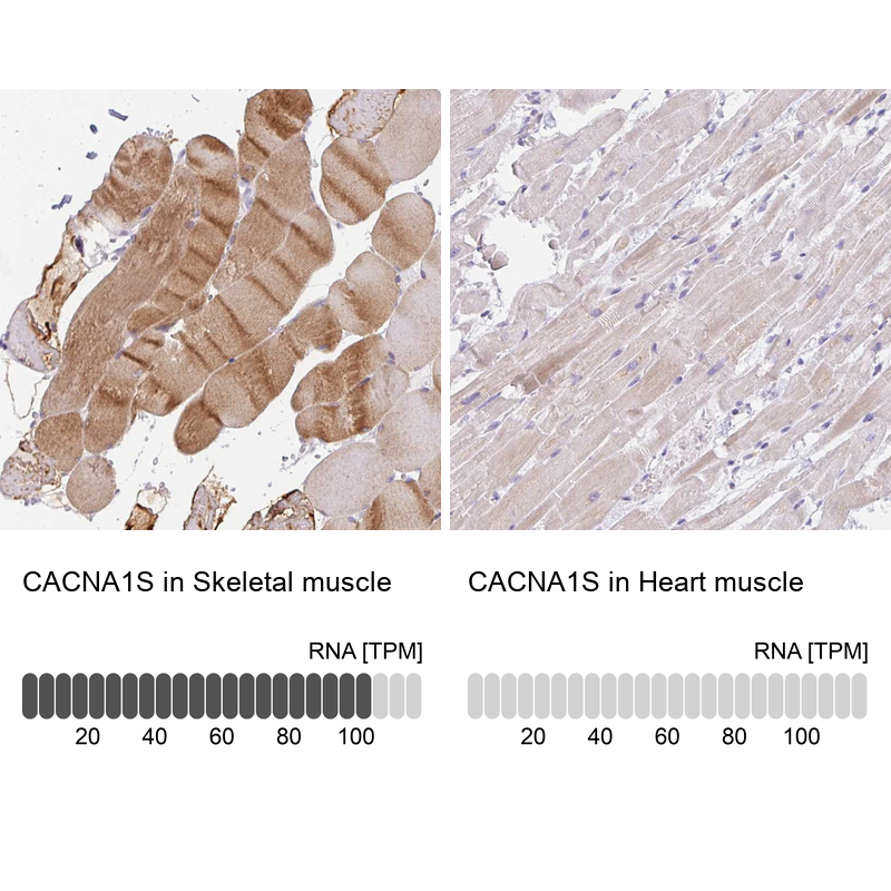 Anti-CACNA1S Antibody