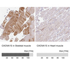 Anti-CACNA1S Antibody