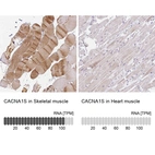 Anti-CACNA1S Antibody