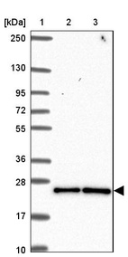 Lane 1: Marker [kDa] 250, 130, 95, 72, 55, 36, 28, 17, 10_br/_Lane 2: Human cell line RT-4_br/_Lane 3: Human cell line U-251MG sp