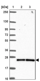 Lane 1: Marker [kDa] 250, 130, 95, 72, 55, 36, 28, 17, 10_br/_Lane 2: Human cell line RT-4_br/_Lane 3: Human cell line U-251MG sp