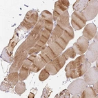 Immunohistochemical staining of human skeletal muscle shows high expression.