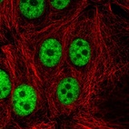 Immunofluorescent staining of human cell line MCF7 shows localization to nucleoplasm.