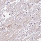 Anti-CACNA1S Antibody