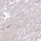 Immunohistochemical staining of human heart muscle shows low expression as expected.