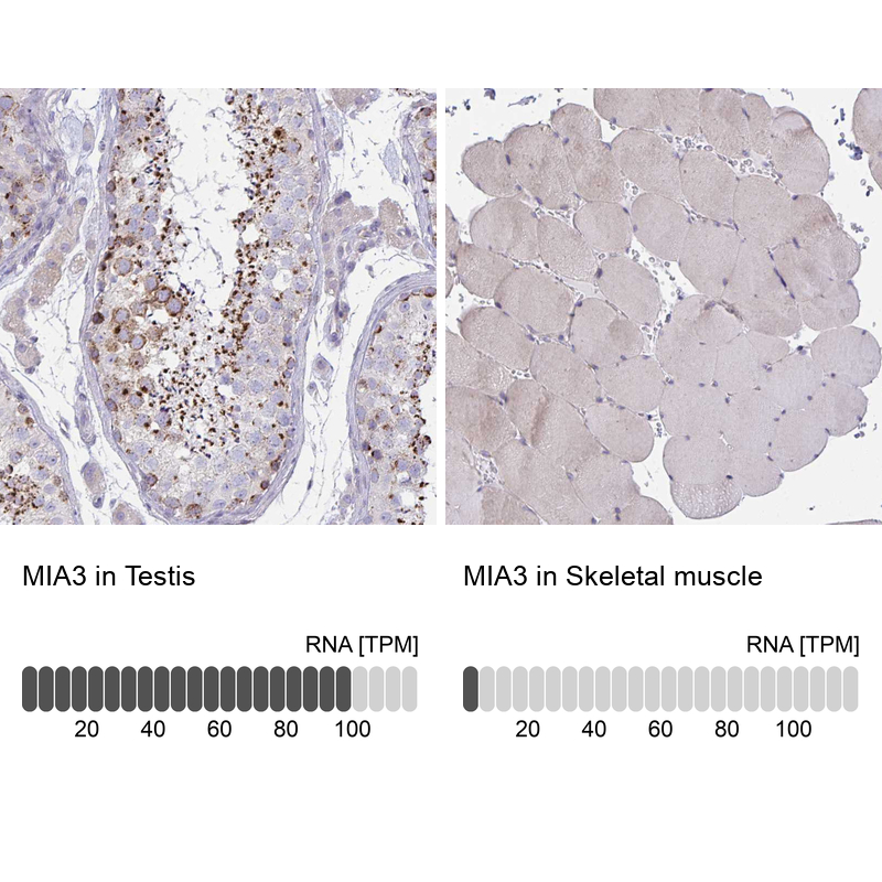Anti-MIA3 Antibody