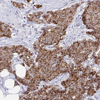 Anti-MIA3 Antibody