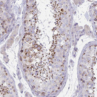 Anti-MIA3 Antibody