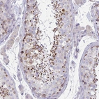 Immunohistochemical staining of human Testis shows strong granular cytoplasmic positivity in cells in seminiferous ducts.