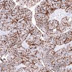 Anti-CLDN3 Antibody