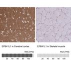 Anti-EPB41L1 Antibody