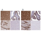 Immunohistochemical staining of human cerebral cortex, fallopian tube, kidney and skeletal muscle using Anti-EPB41L1 antibody HPA056817 (A) shows similar protein distribution across tissues to independent antibody HPA054104 (B).