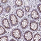 Immunohistochemical staining of human Rectum shows strong granular cytoplasmic positivity in glandular cells.