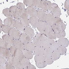 Immunohistochemical staining of human Skeletal muscle shows very weak cytoplasmic positivity in myocytes.