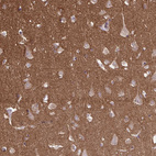 Immunohistochemical staining of human cerebral cortex shows strong cytoplasmic positivity in neuropil.