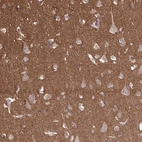 Immunohistochemical staining of human cerebral cortex shows strong cytoplasmic positivity in neuropil.