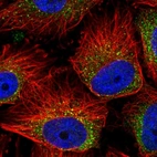 Immunofluorescent staining of human cell line U-251 MG shows localization to vesicles.