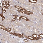Immunohistochemical staining of human kidney shows strong membranous positivity in cells in distal tubules.