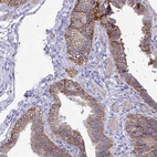Immunohistochemical staining of human fallopian tube strong membranous positivity in glandular cells.