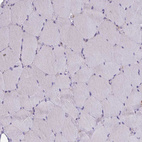 Immunohistochemical staining of human skeletal muscle shows no positivity in myocytes as expected.