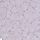 Immunohistochemical staining of human skeletal muscle shows no positivity in myocytes as expected.