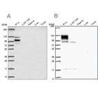 Anti-EPB41L1 Antibody